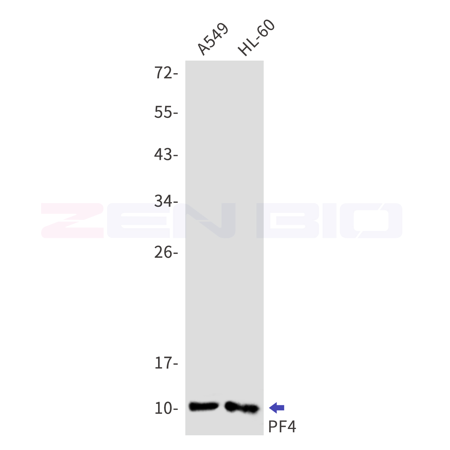 Western blot detection of PF4 in A549,HL-60 cell lysates using PF4 Rabbit mAb(1:1000 diluted).Predicted band size:11kDa.Observed band size:11kDa.