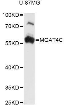 Western blot - MGAT4C Polyclonal Antibody 