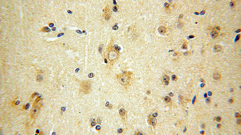 Immunohistochemical of paraffin-embedded human brain using Catalog No:111614(IFFO1 antibody) at dilution of 1:100 (under 40x lens)