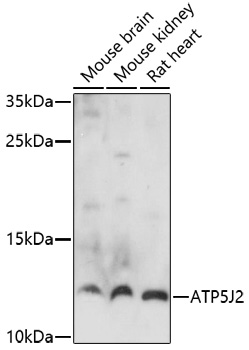 Western blot - ATP5J2 Polyclonal Antibody 