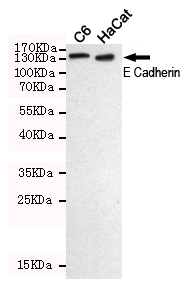Western blot detection of E-Cadherin in C6 and HaCat cell lysates using E Cadherin mouse mAb (dilution 1:500).Predicted band size:135KDa.Observed band size:135KDa.