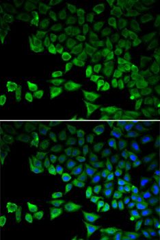 Immunofluorescence - RIG-I / DDX58 Polyclonal Antibody 