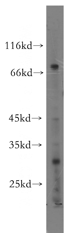 A549 cells were subjected to SDS PAGE followed by western blot with Catalog No:116697(UTP3 antibody) at dilution of 1:1000
