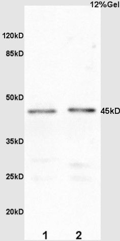 Fig2: Sample:; Embryo(Mouse) lysate at 30ug;; Embryo(Mouse) lysate at 30ug;; Primary: Anti-Osterix at 1:200 dilution;; Secondary: HRP conjugated Goat Anti-Rabbit IgG(bs-0295G-HRP) at 1: 3000 dilution;; Predicted band size : 45kD; Observed band size : 45kD