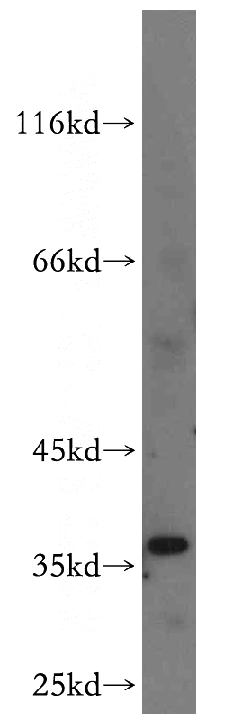 HEK-293 cells were subjected to SDS PAGE followed by western blot with Catalog No:112730(MOGAT2 antibody) at dilution of 1:300