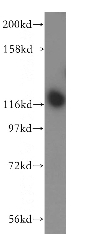 HeLa cells were subjected to SDS PAGE followed by western blot with Catalog No:111872(INTS3 antibody) at dilution of 1:500