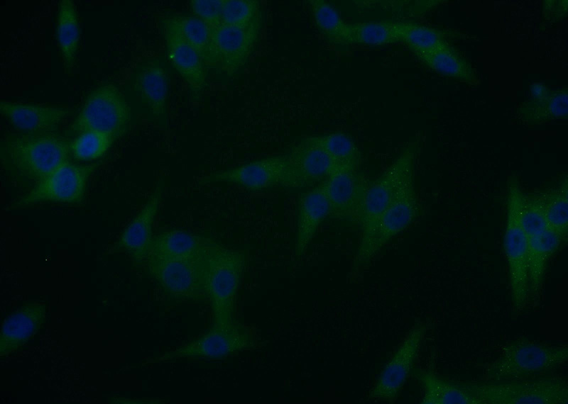 Immunofluorescent analysis of A375 cells using Catalog No:116847(WBP2 Antibody) at dilution of 1:25 and Alexa Fluor 488-congugated AffiniPure Goat Anti-Rabbit IgG(H+L)