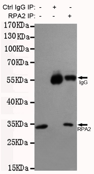 Immunoprecipitation analysis of Hela cell lysates using RPA32/RPA2 mouse mAb.