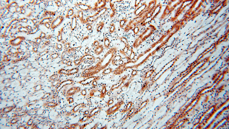 Immunohistochemical of paraffin-embedded human kidney using Catalog No:115393(SMN2 antibody) at dilution of 1:100 (under 10x lens)