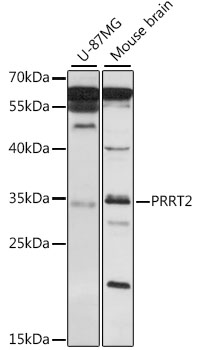 Western blot - PRRT2 Polyclonal Antibody 