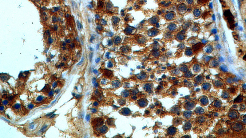 Immunohistochemical of paraffin-embedded human testis using Catalog No:109930(DHX32 antibody) at dilution of 1:100 (under 40x lens)