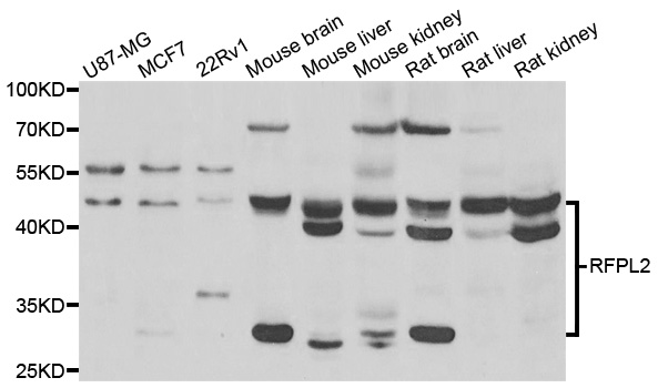 Western blot - RFPL2 Polyclonal Antibody 