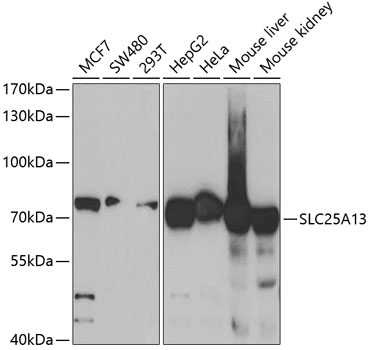 Western blot - SLC25A13 Polyclonal Antibody 