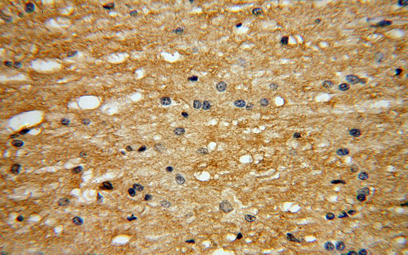Immunohistochemical of paraffin-embedded human brain using Catalog No:110492(EVI2A antibody) at dilution of 1:100 (under 40x lens)