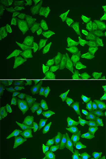 Immunofluorescence - ALAS2 Polyclonal Antibody 