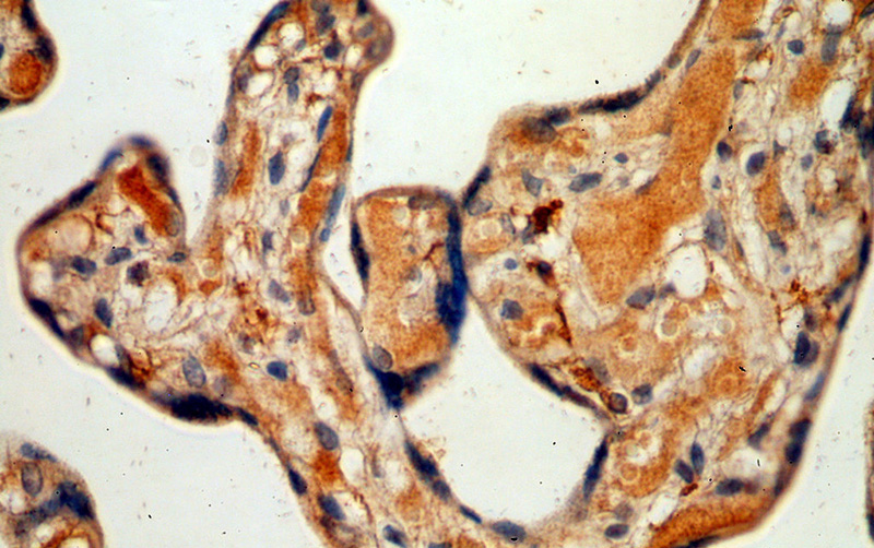 Immunohistochemical of paraffin-embedded human placenta using Catalog No:115489(SocS3 antibody) at dilution of 1:50 (under 40x lens)