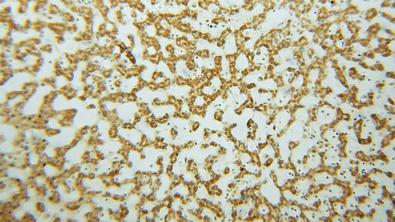 Immunohistochemical of paraffin-embedded human liver using Catalog No:111192(GSTT1 antibody) at dilution of 1:50 (under 10x lens)