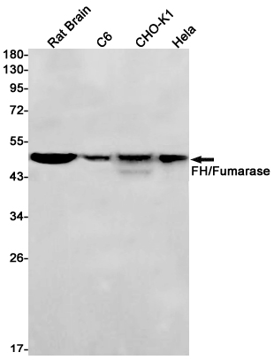Western blot detection of FH/Fumarase in Rat Brain,C6,CHO-K1,Hela cell lysates using FH/Fumarase Rabbit mAb(1:1000 diluted).Predicted band size:55kDa.Observed band size:49kDa.