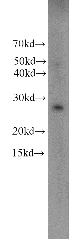 human placenta tissue were subjected to SDS PAGE followed by western blot with Catalog No:111448(HPGD antibody) at dilution of 1:300