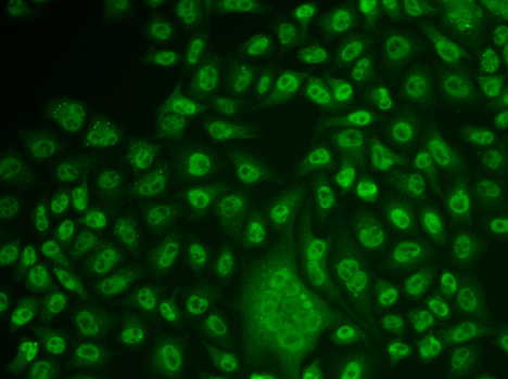 Immunofluorescence - TFPT Polyclonal Antibody 
