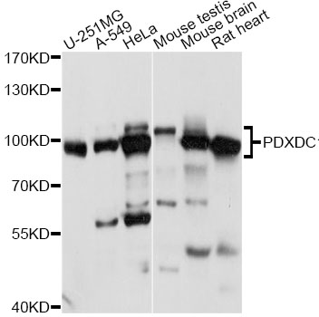 Western blot - PDXDC1 Polyclonal Antibody 