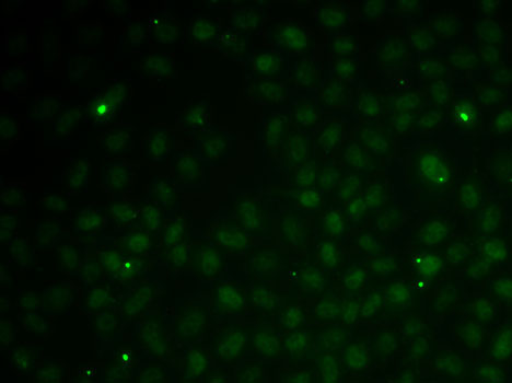 Immunofluorescence - RAD51C Polyclonal Antibody 