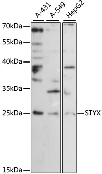 Western blot - STYX Polyclonal Antibody 