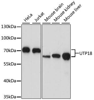 Western blot - UTP18 Polyclonal Antibody 