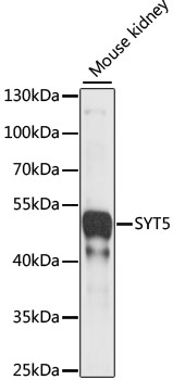 Western blot - SYT5 Polyclonal Antibody 