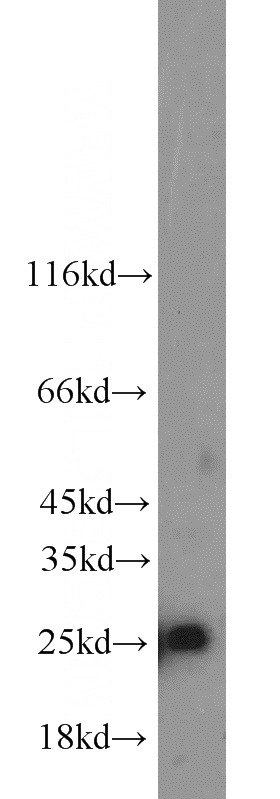 Jurkat cells were subjected to SDS PAGE followed by western blot with Catalog No:115996(TFAM antibody) at dilution of 1:600