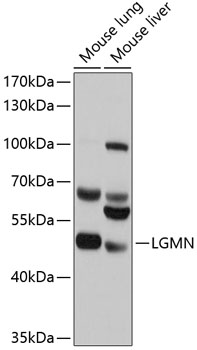 Western blot - LGMN Polyclonal Antibody 