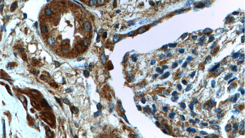 Immunohistochemistry of paraffin-embedded human kidney tissue slide using Catalog No:115199(Corticosteroid binding globulin Antibody) at dilution of 1:200 (under 40x lens).