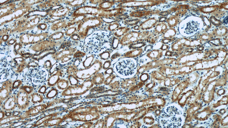 Immunohistochemical of paraffin-embedded human kidney using Catalog No:110609(FDX1 antibody) at dilution of 1:50 (under 10x lens)