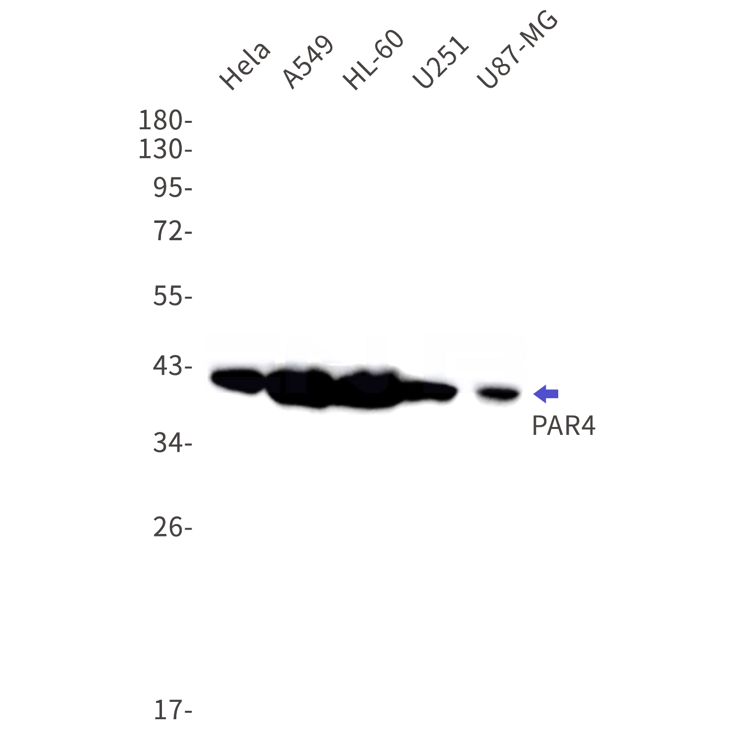 Western blot detection of PAR4 in Hela,A549,HL-60,U251,U87-MG cell lysates using PAR4 Rabbit mAb(1:1000 diluted).Predicted band size:37kDa.Observed band size:41kDa.