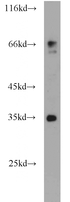 mouse liver tissue were subjected to SDS PAGE followed by western blot with Catalog No:111712(HTR4 antibody) at dilution of 1:500