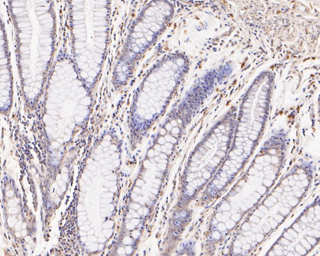 Fig5:; Immunohistochemical analysis of paraffin-embedded human colon tissue using anti-FYCO1 antibody. The section was pre-treated using heat mediated antigen retrieval with Tris-EDTA buffer (pH 8.0-8.4) for 20 minutes.The tissues were blocked in 5% BSA for 30 minutes at room temperature, washed with ddH; 2; O and PBS, and then probed with the primary antibody ( 1/500) for 30 minutes at room temperature. The detection was performed using an HRP conjugated compact polymer system. DAB was used as the chromogen. Tissues were counterstained with hematoxylin and mounted with DPX.