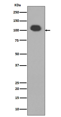 Western blot analysis of PSD95 expression in Mouse brain tissue lysate.
