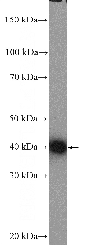 Jurkat cells were subjected to SDS PAGE followed by western blot with Catalog No:116271(TMOD3 Antibody) at dilution of 1:1000