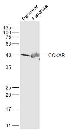 Fig3: Sample:; Pancreas (Mouse) Lysate at 40 ug; Pancreas(Rat) Lysate at 40 ug; Primary: Anti-CCKAR at 1/1000 dilution; Secondary: IRDye800CW Goat Anti-Rabbit IgG at 1/20000 dilution; Predicted band size: 48 kD; Observed band size: 48 kD