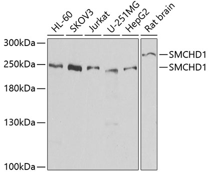 Western blot - SMCHD1 Polyclonal Antibody 