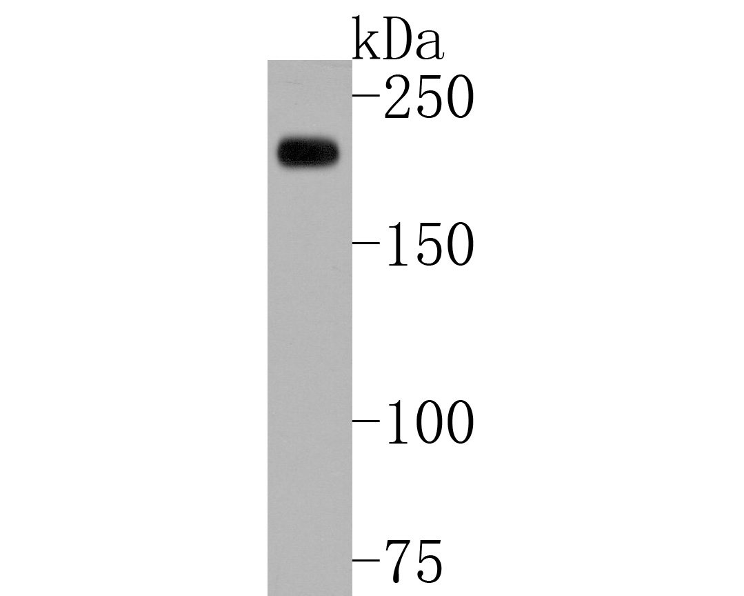 Fig1:; Western blot analysis of Alpha-2-macroglobulin on LO2 cell lysates. Proteins were transferred to a PVDF membrane and blocked with 5% BSA in PBS for 1 hour at room temperature. The primary antibody ( 1/500) was used in 5% BSA at room temperature for 2 hours. Goat Anti-Rabbit IgG - HRP Secondary Antibody (HA1001) at 1:5,000 dilution was used for 1 hour at room temperature.
