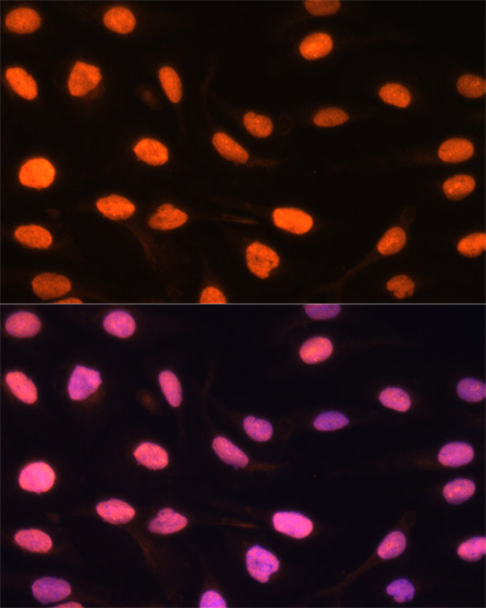 Immunofluorescence - ZBED1 Polyclonal Antibody 