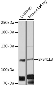 Western blot - EPB41L3 Polyclonal Antibody 