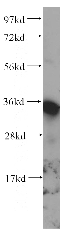 HeLa cells were subjected to SDS PAGE followed by western blot with Catalog No:110734(FN3K antibody) at dilution of 1:500