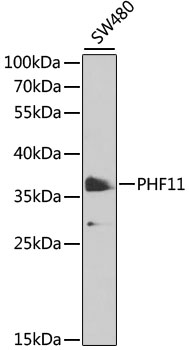 Western blot - PHF11 Polyclonal Antibody 