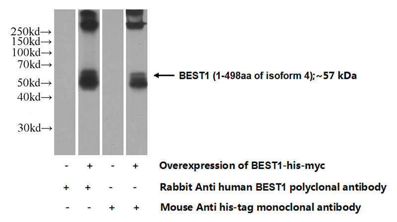 Transfected HEK-293 cells were subjected to SDS PAGE followed by western blot with Catalog No:117120(BEST1 Antibody) at dilution of 1:1000