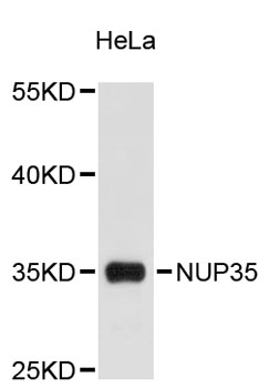 Western blot - NUP35 Polyclonal Antibody 
