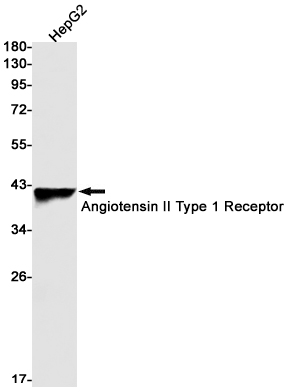 Western blot detection of Angiotensin II Type 1 Receptor in HepG2 cell lysates using Angiotensin II Type 1 Receptor Rabbit mAb(1:1000 diluted).Predicted band size:41kDa.Observed band size:41kDa.