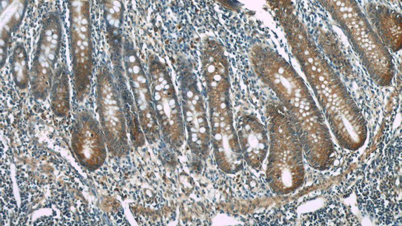 Immunohistochemical of paraffin-embedded human appendix using Catalog No:107218(FKBP52 antibody) at dilution of 1:100 (under 10x lens)