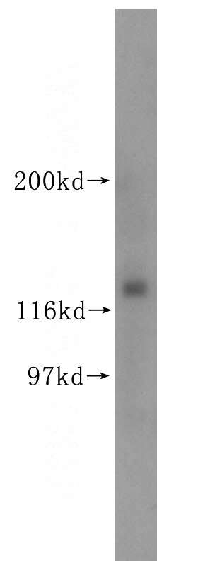 mouse testis tissue were subjected to SDS PAGE followed by western blot with Catalog No:112070(KIRREL3 antibody) at dilution of 1:400